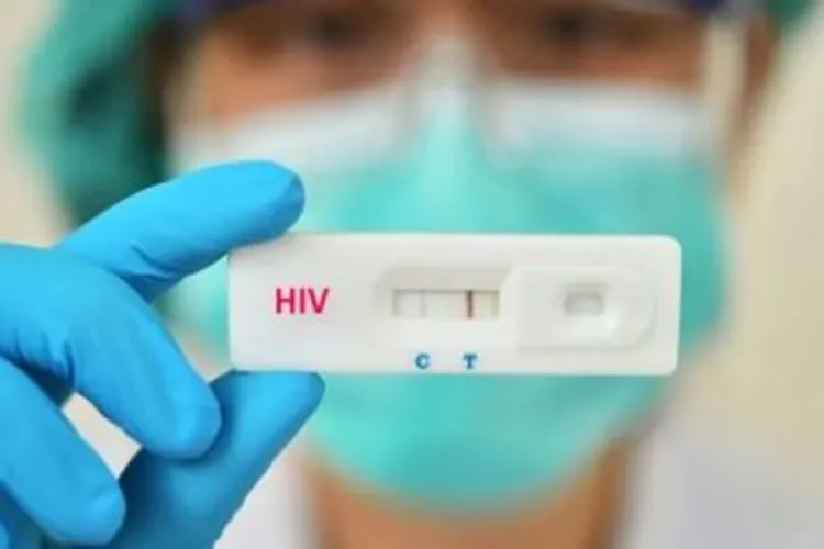 Variante do HIV é detectada na Bahia, no Rio de Janeiro e no Rio Grande do Sul