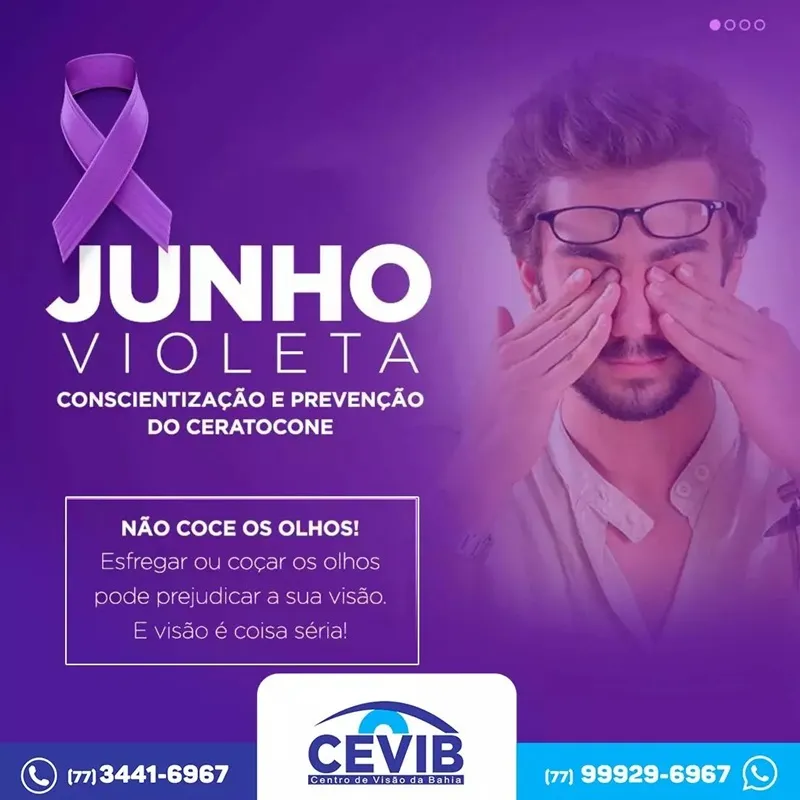 Cevib destaca Junho Violeta e importância da prevenção do ceratocone