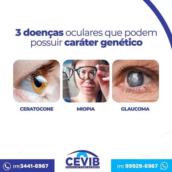 Cevib: Conheça três doenças oculares que podem ter caráter genético