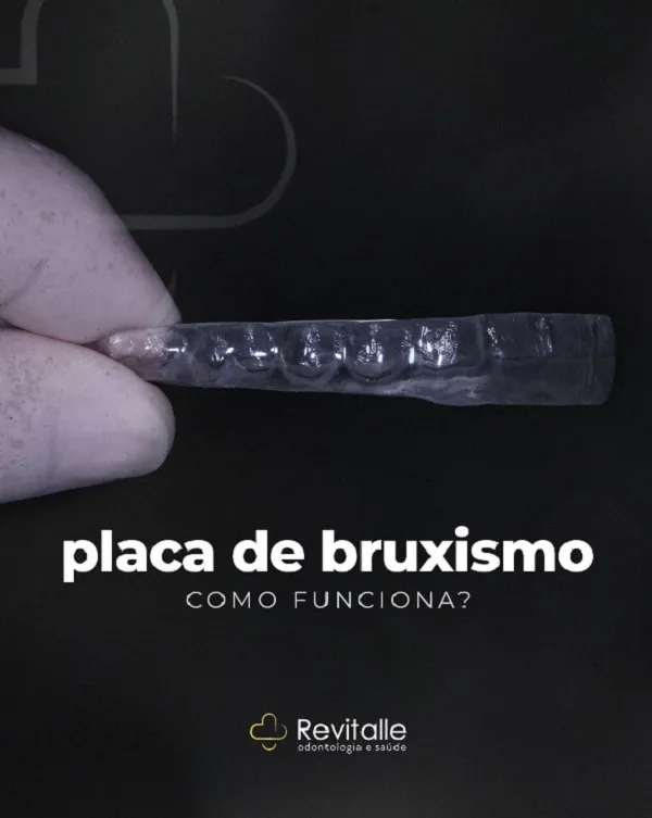 Revitalle Odontologia explica quais os benefícios da placa para bruxismo