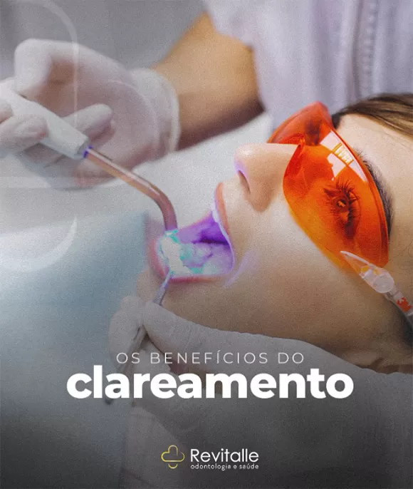 Brumado: Revitalle realiza clareamento dental de forma segura e eficiente