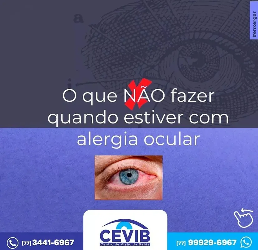 Cevib alerta para o que não se deve fazer em caso de alergia ocular